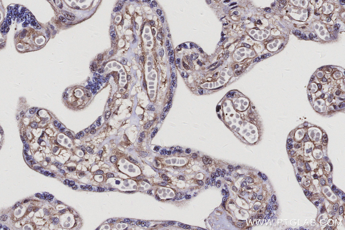 IHC staining of human placenta using 29846-1-AP