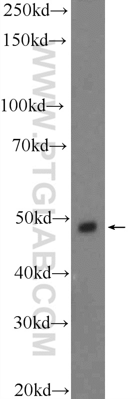 STK25 Polyclonal antibody