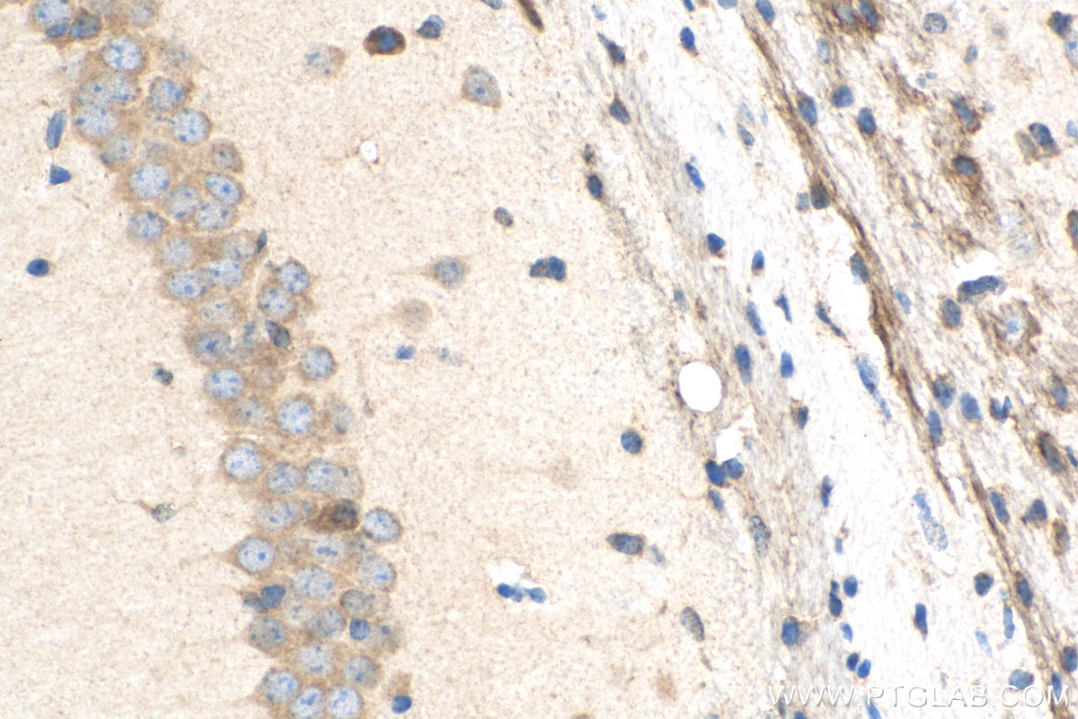 IHC staining of mouse brain using Biotin-25821