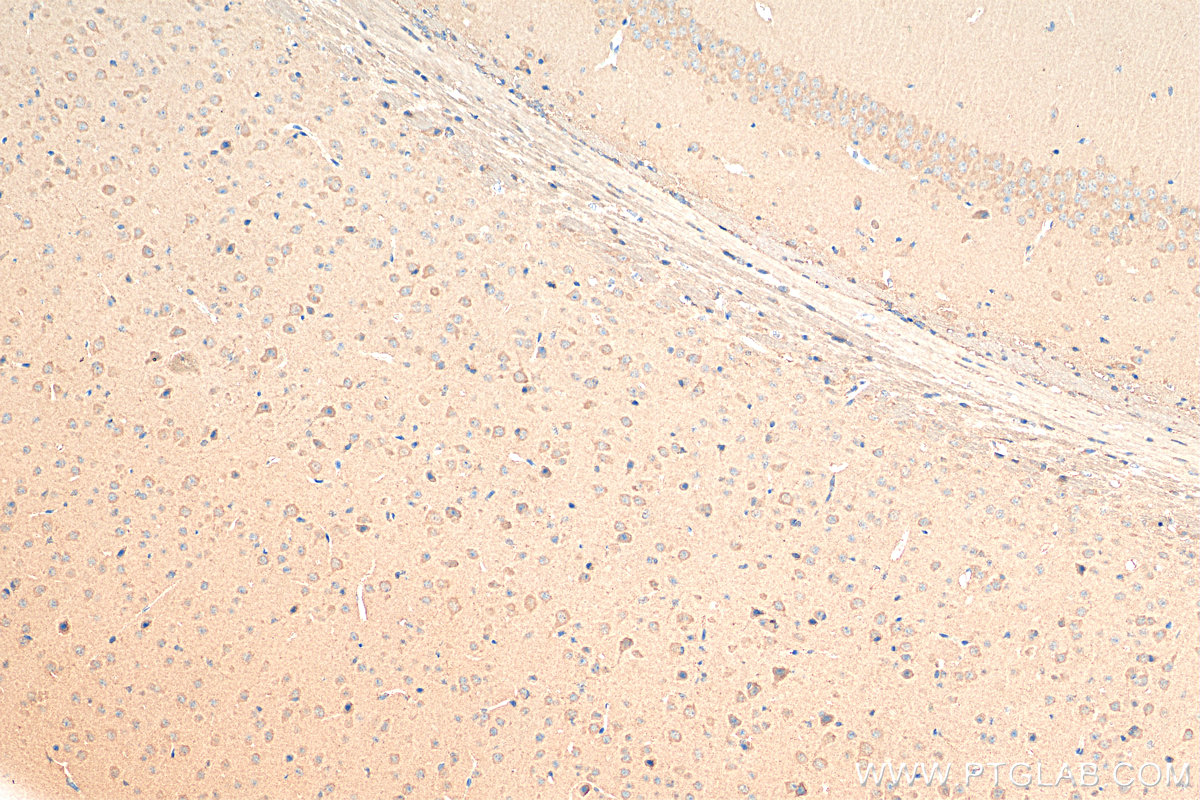 IHC staining of mouse brain using Biotin-25821