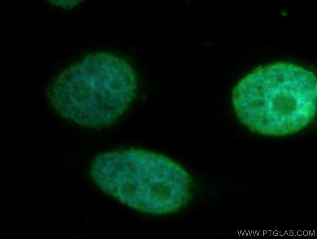 IF Staining of HeLa using 12097-1-AP