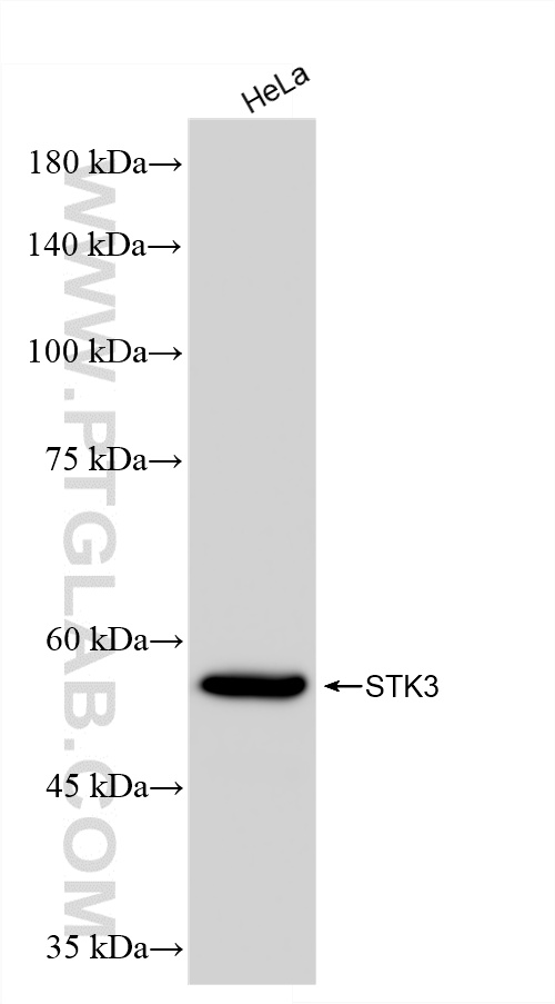 WB analysis of HeLa using 87269-1-RR