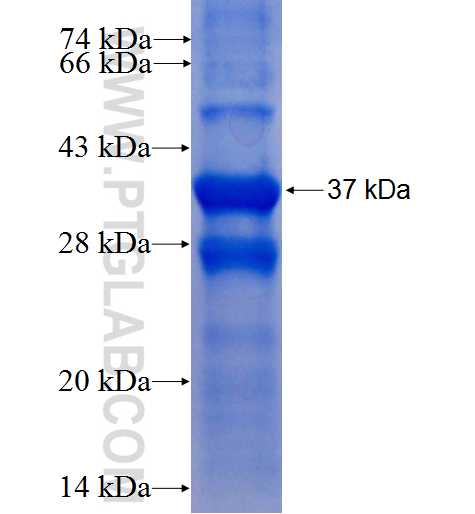 STK32B fusion protein Ag8271 SDS-PAGE STK32B fusion protein Ag8271 SDS-PAGE