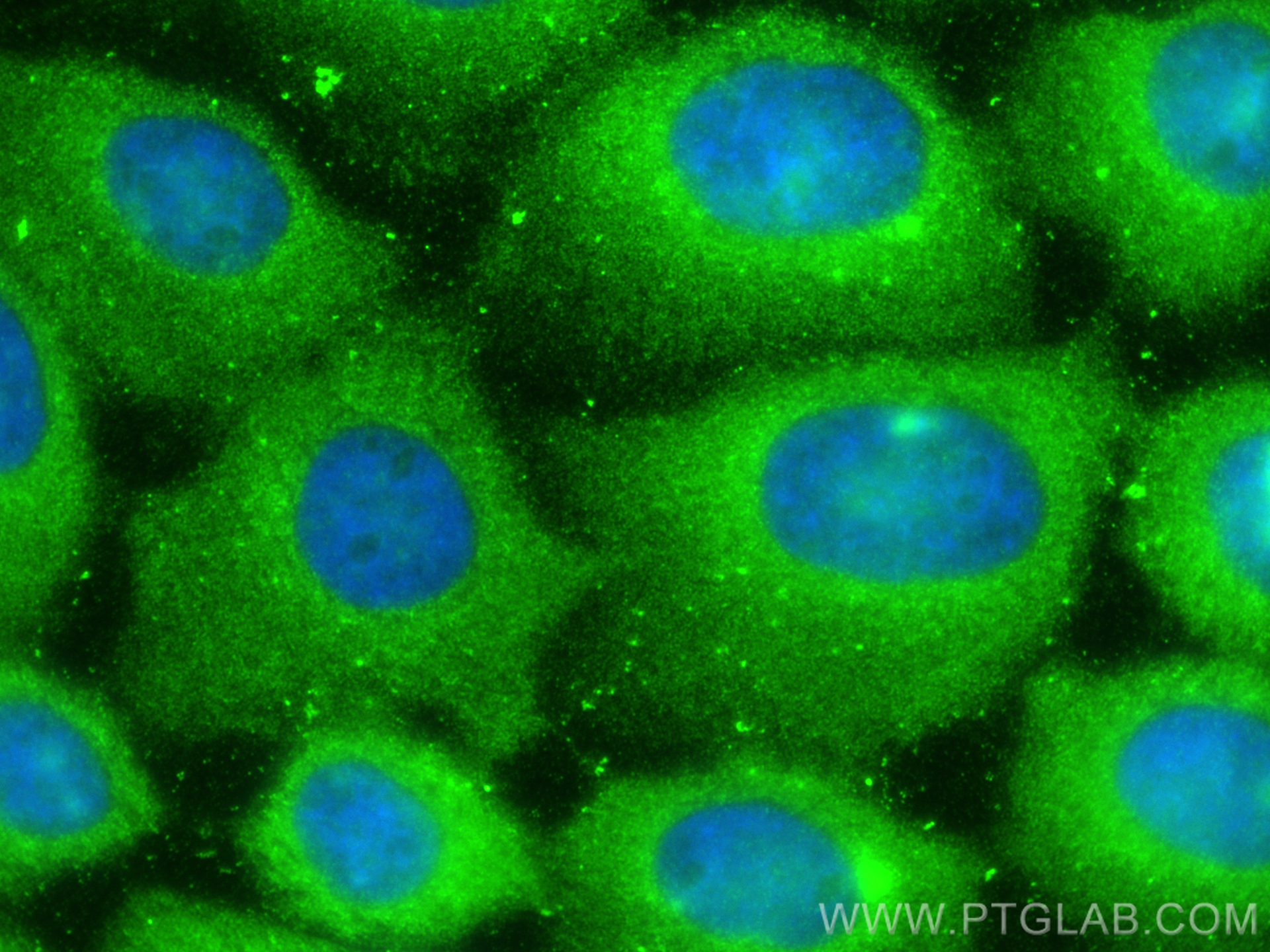 IF Staining of A431 using 11434-1-AP