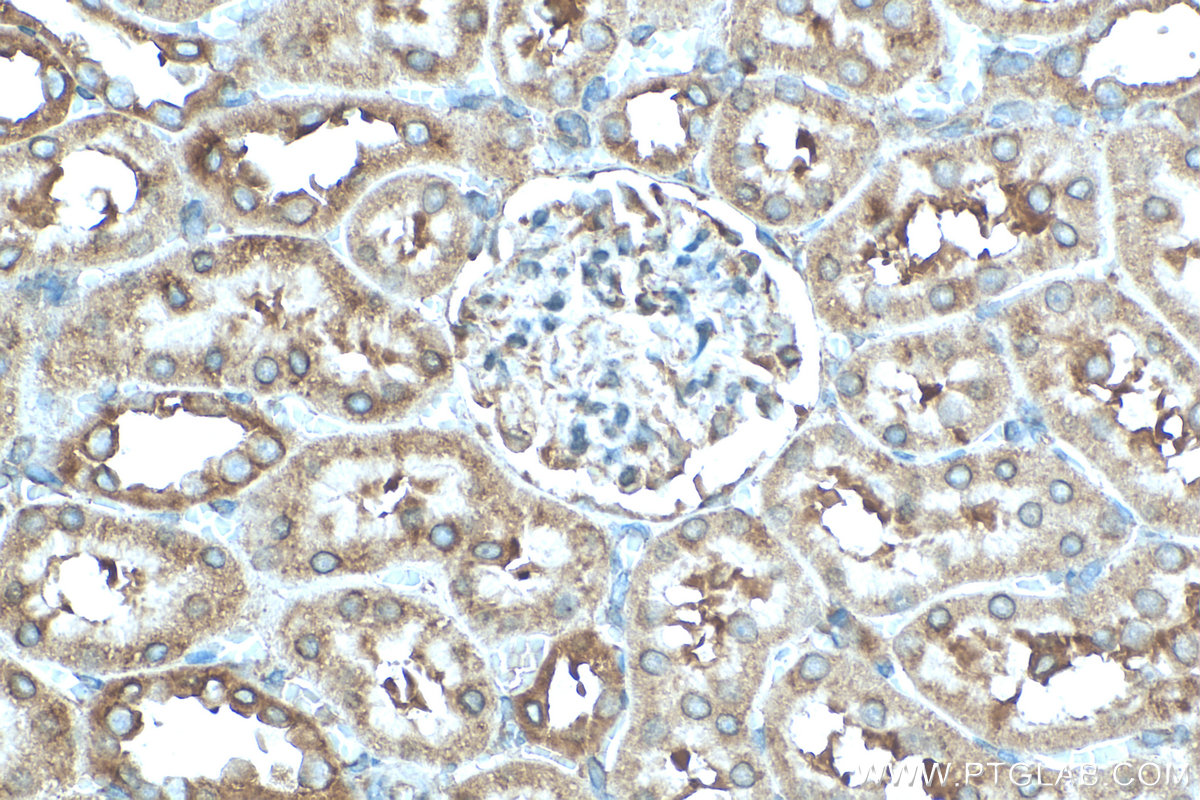IHC staining of rat kidney using 11434-1-AP