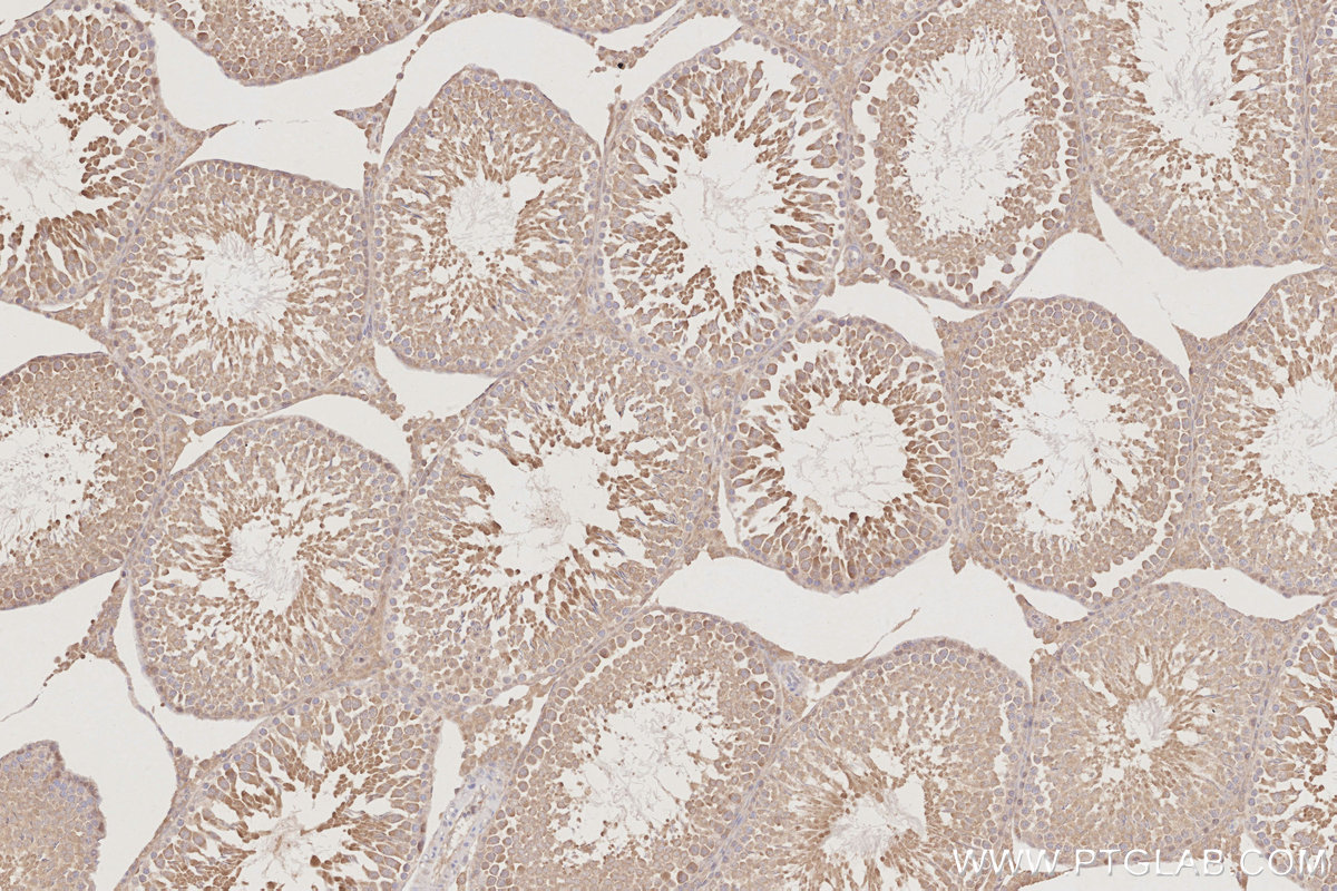 IHC staining of rat testis using 12857-1-AP IHC staining of rat testis using 12857-1-AP