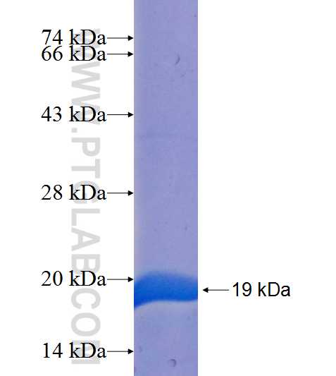 STK35 fusion protein Ag25250 SDS-PAGE STK35 fusion protein Ag25250 SDS-PAGE