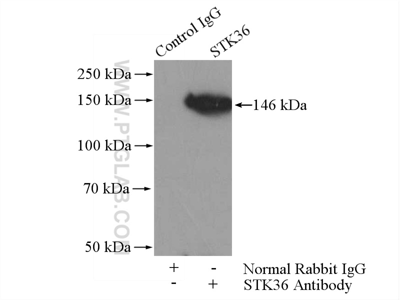 IP experiment of mouse testis using 12559-1-AP (same clone as 12559-1-PBS)