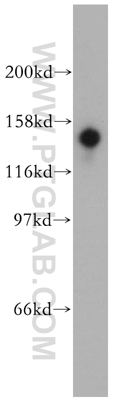 WB analysis of mouse testis using 12559-1-AP