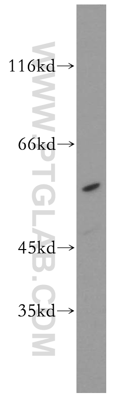 STK38 Polyclonal antibody