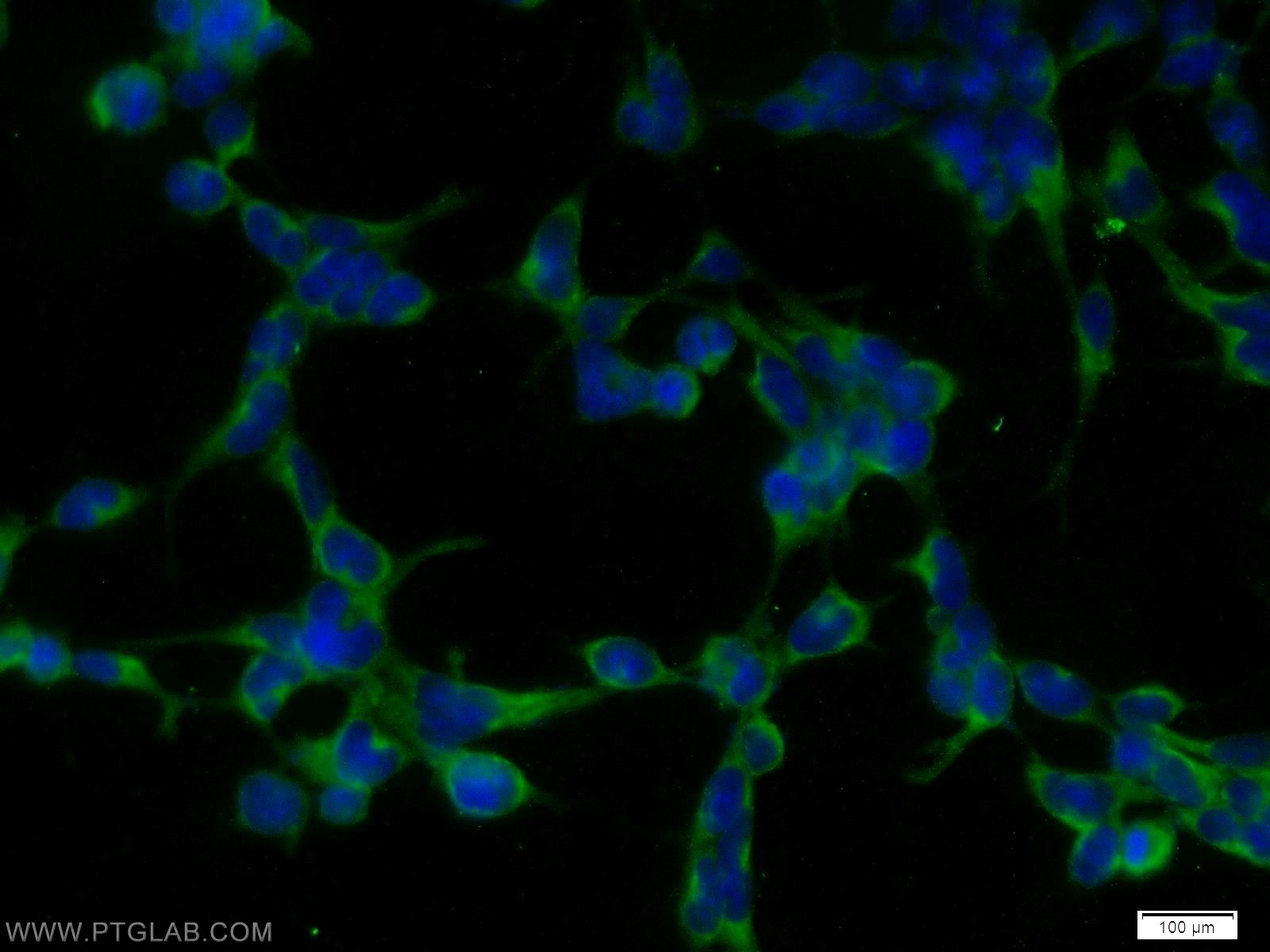 IF Staining of HEK-293 using 55335-1-AP