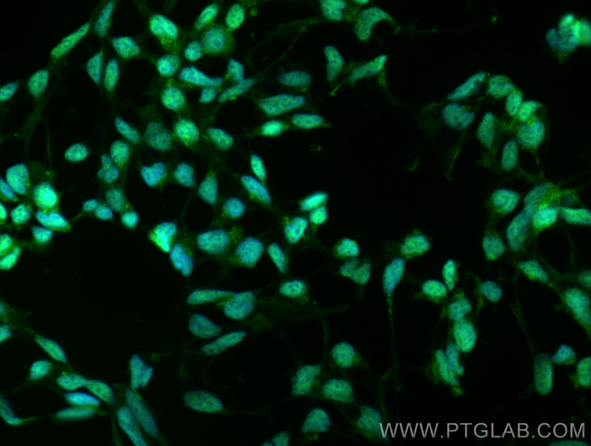 IF Staining of HEK-293 using 55335-1-AP
