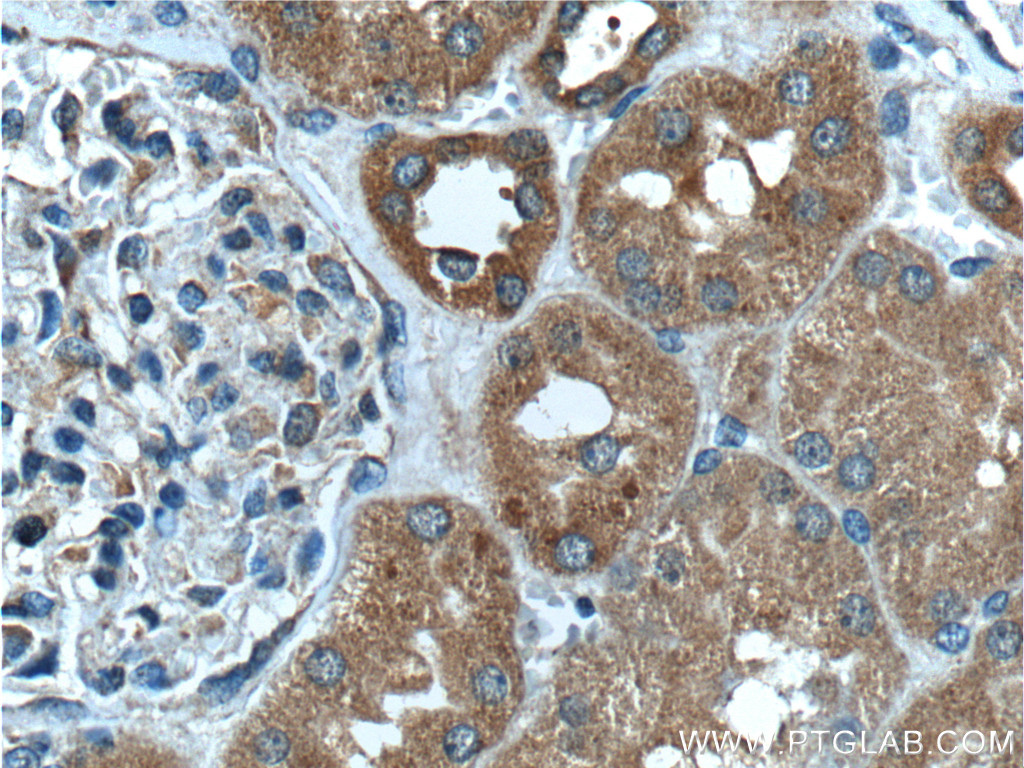 IHC staining of human kidney using 55335-1-AP