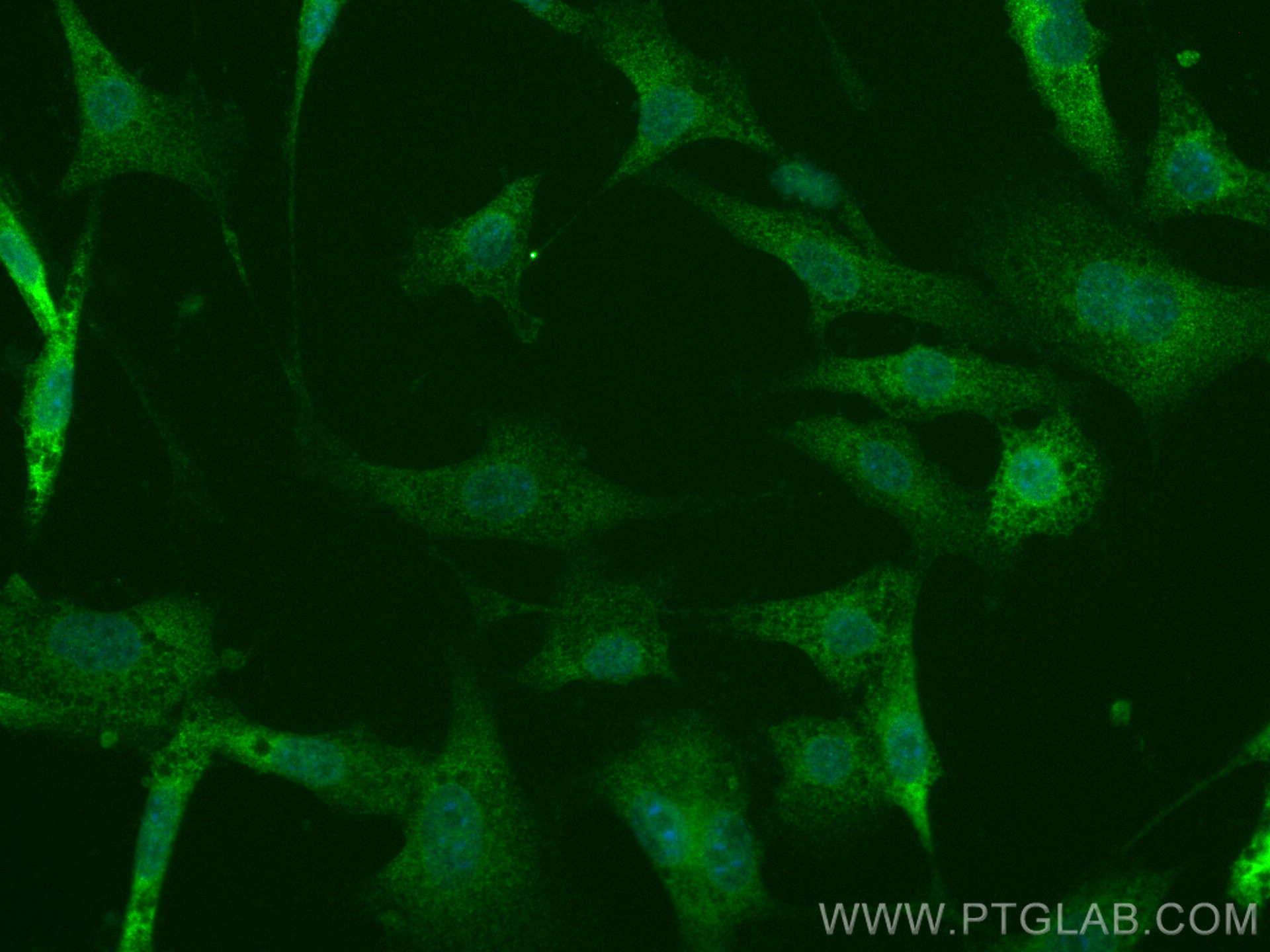 IF Staining of NIH/3T3 using 83081-2-RR (same clone as 83081-2-PBS)