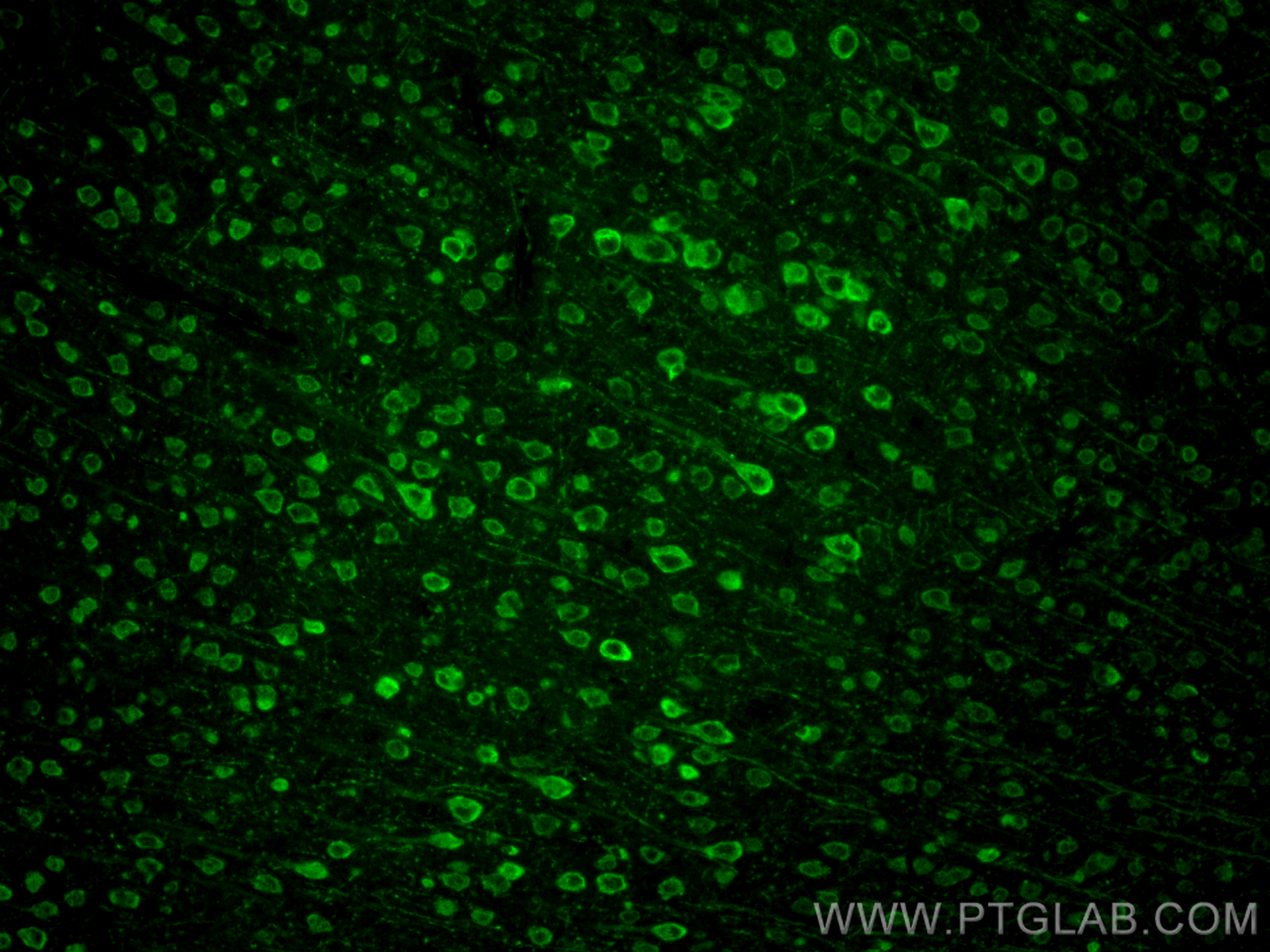 IF Staining of mouse brain using 83081-2-RR (same clone as 83081-2-PBS)