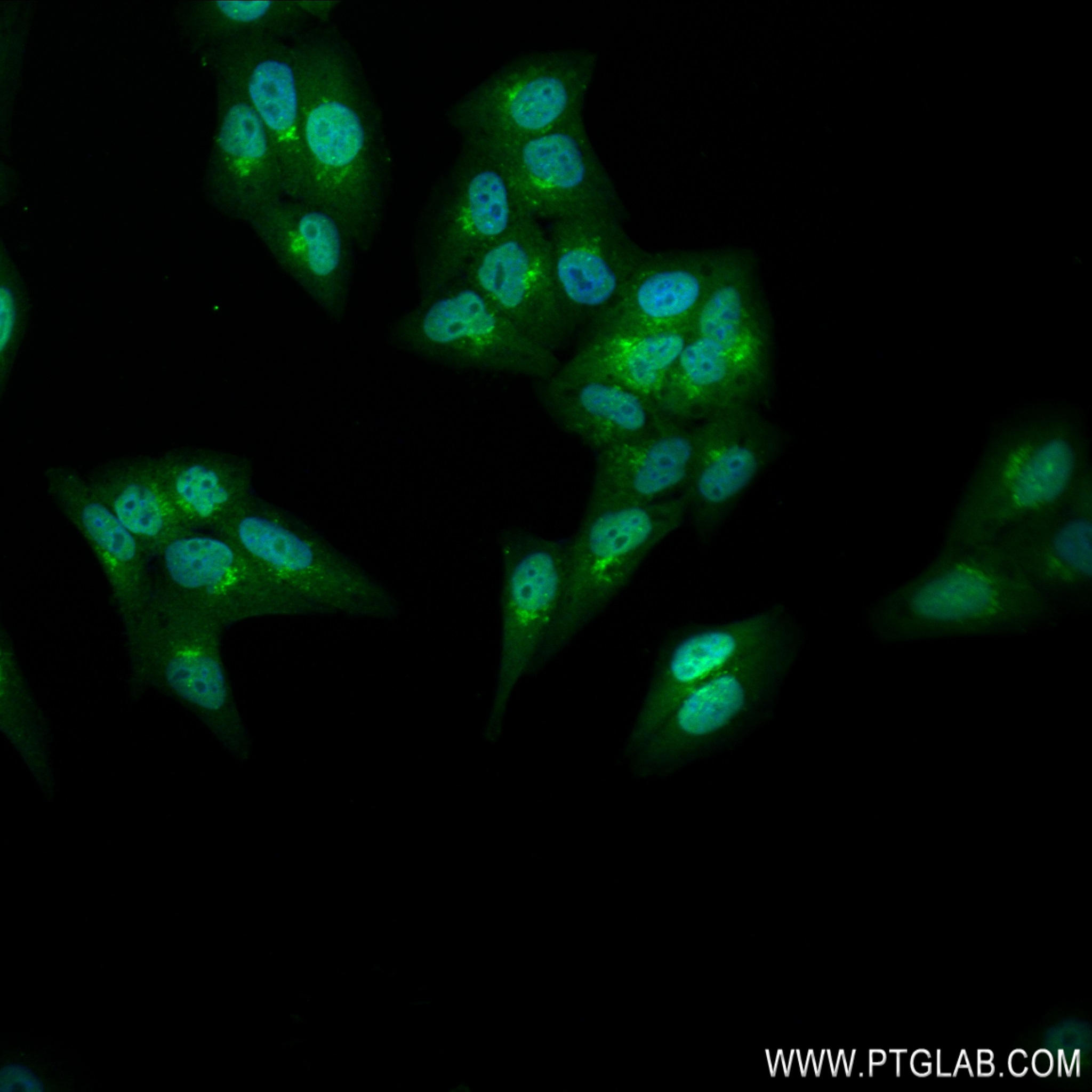 IF Staining of HepG2 using 83081-3-RR (same clone as 83081-3-PBS)