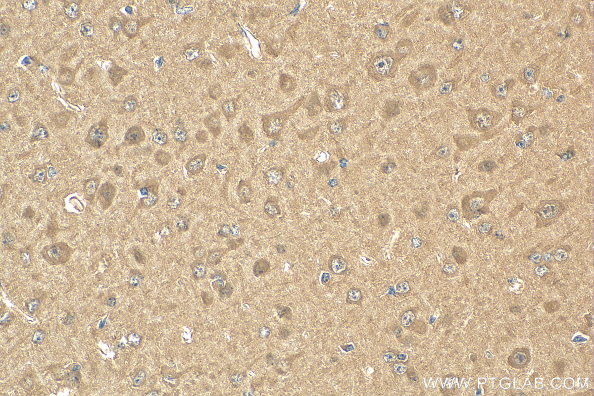IHC staining of mouse brain using 83081-3-RR (same clone as 83081-3-PBS)