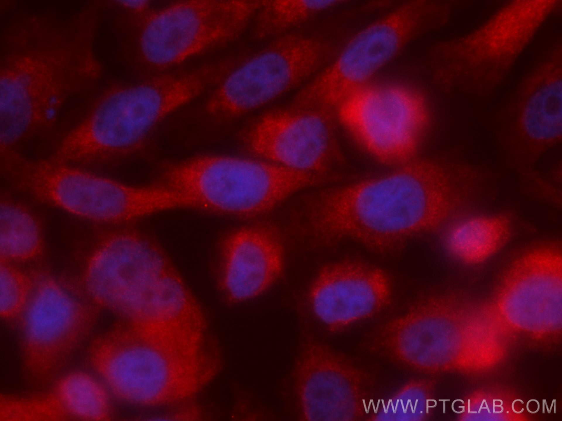 IF Staining of PC-3 using CL594-66663