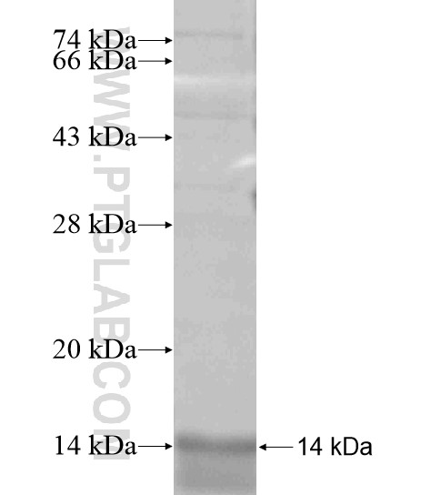 STK4 fusion protein Ag18761 SDS-PAGE STK4 fusion protein Ag18761 SDS-PAGE