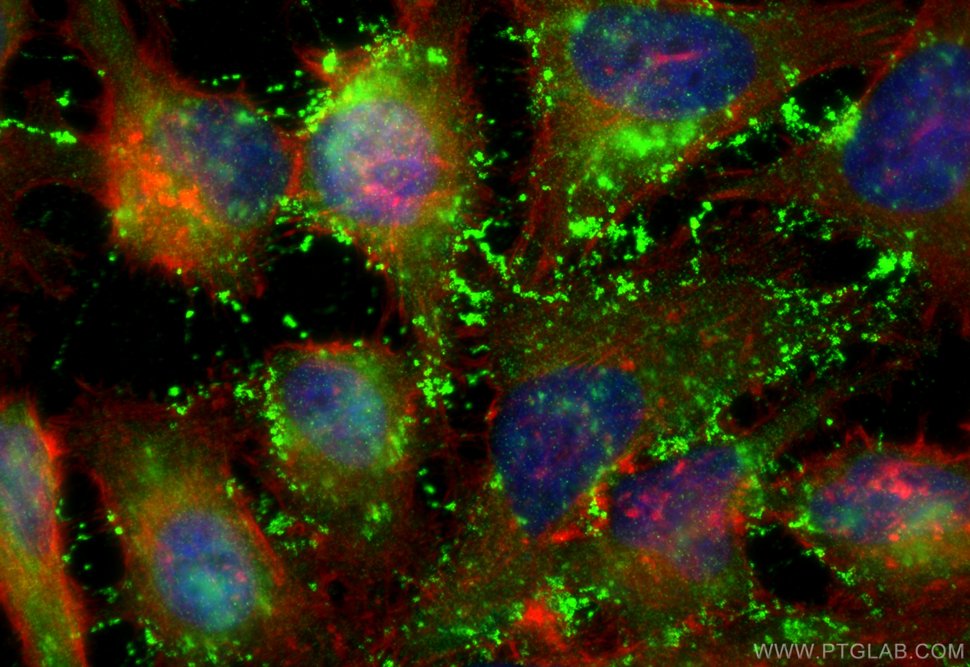 IF Staining of HeLa using 11157-1-AP