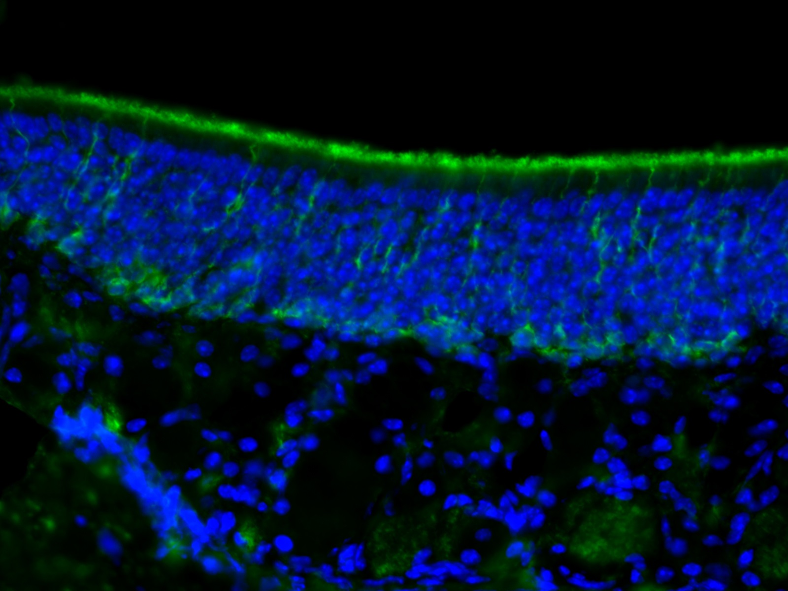 IF Staining of mouse olfactory epithelium tissue using 66090-1-Ig
