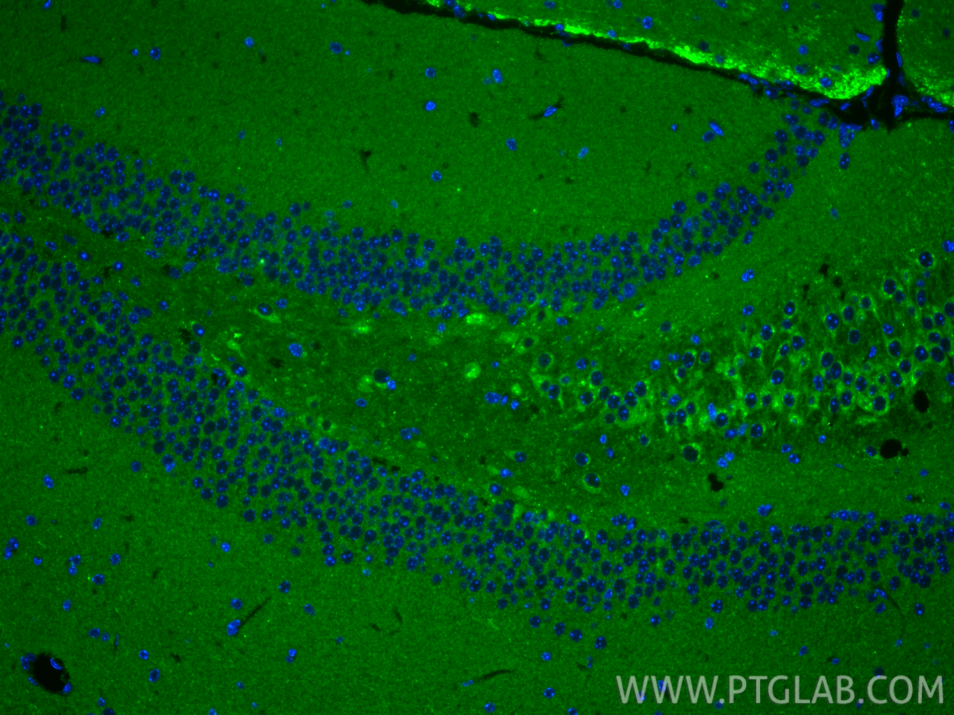 IF Staining of mouse brain using 10586-1-AP IF Staining of mouse brain using 10586-1-AP