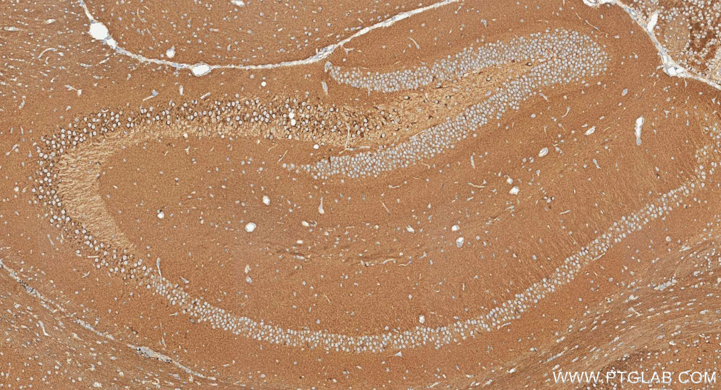 IHC staining of mouse brain using 10586-1-AP IHC staining of mouse brain using 10586-1-AP