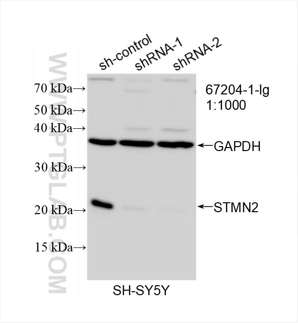 WB analysis of SH-SY5Y using 67204-1-Ig (same clone as 67204-1-PBS)