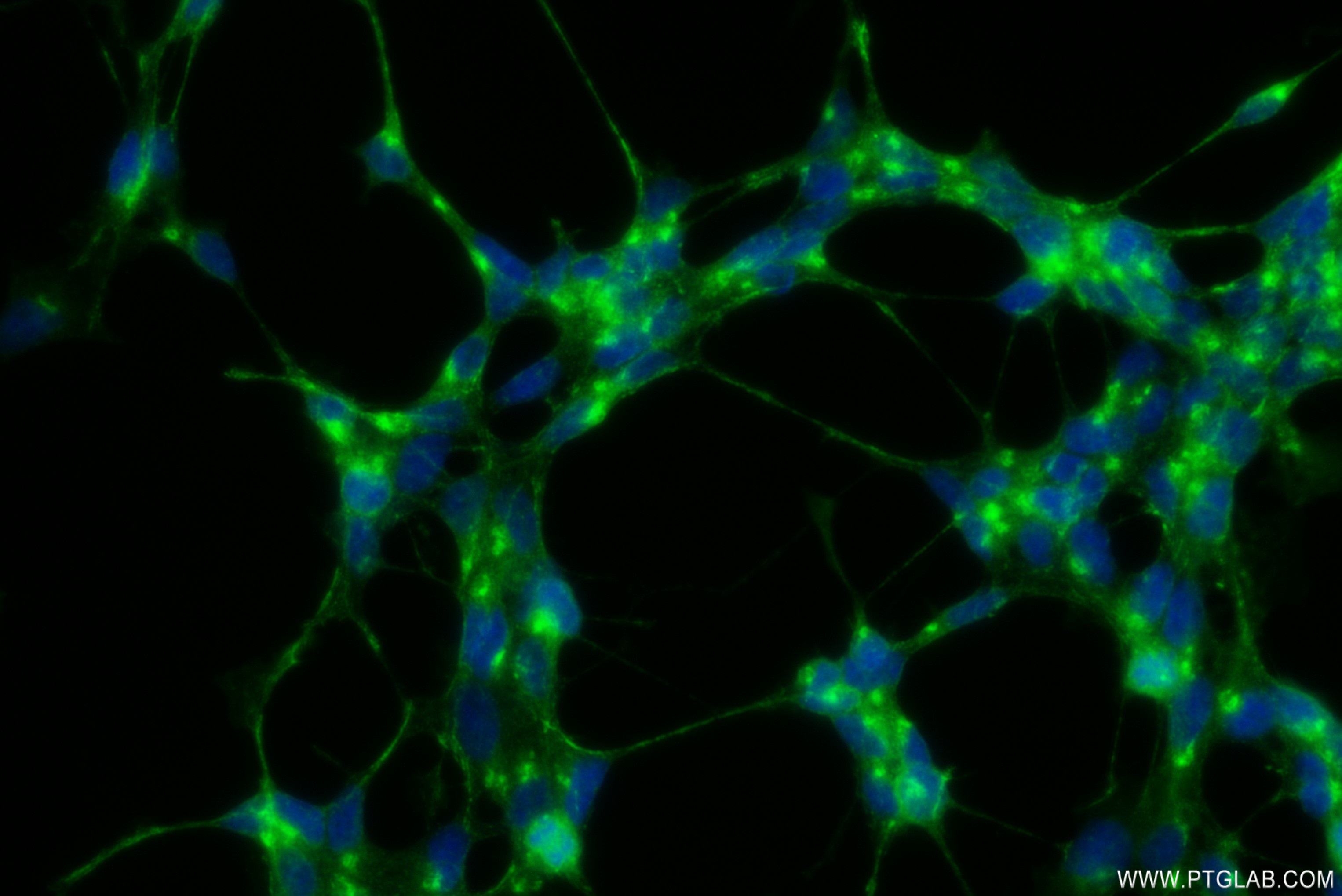 IF Staining of SH-SY5Y using 82925-1-RR (same clone as 82925-1-PBS)