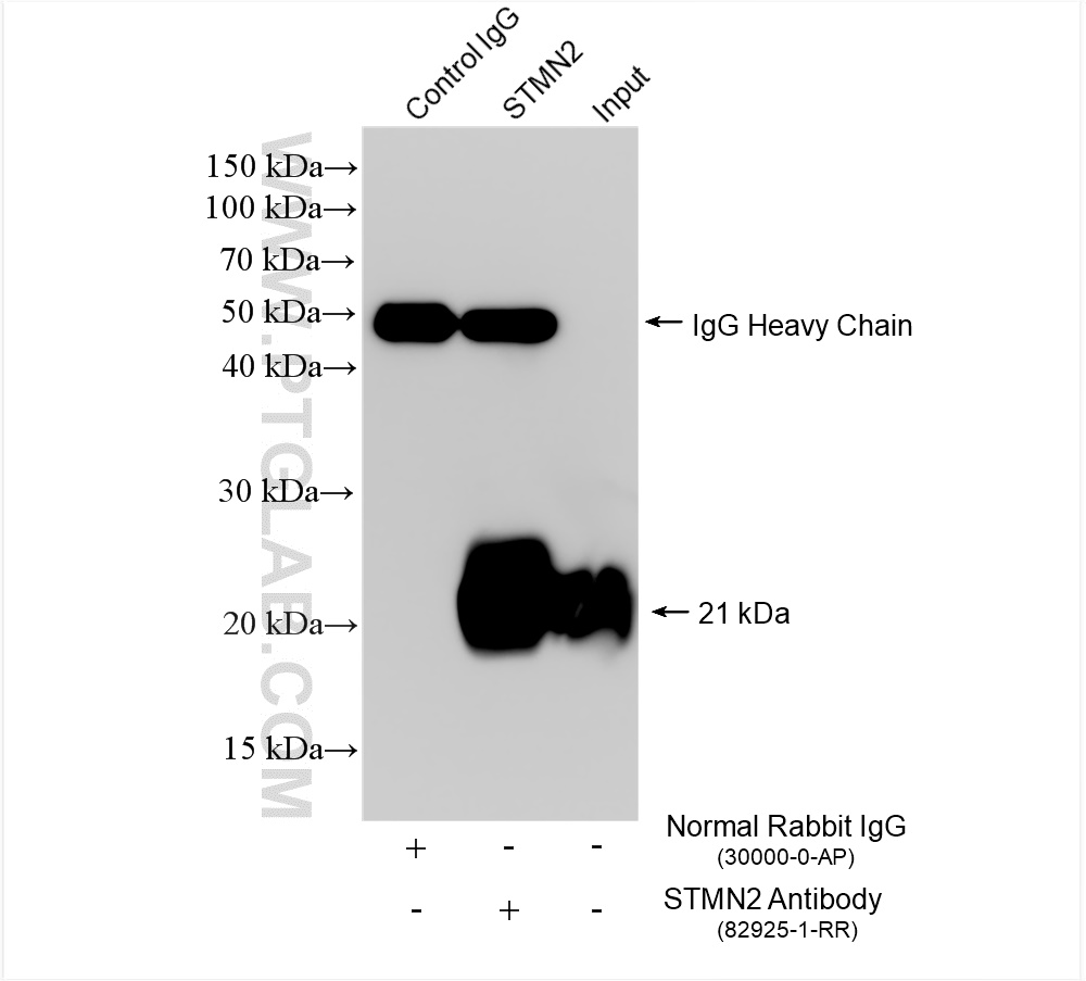 IP experiment of mouse brain using 82925-1-RR (same clone as 82925-1-PBS)