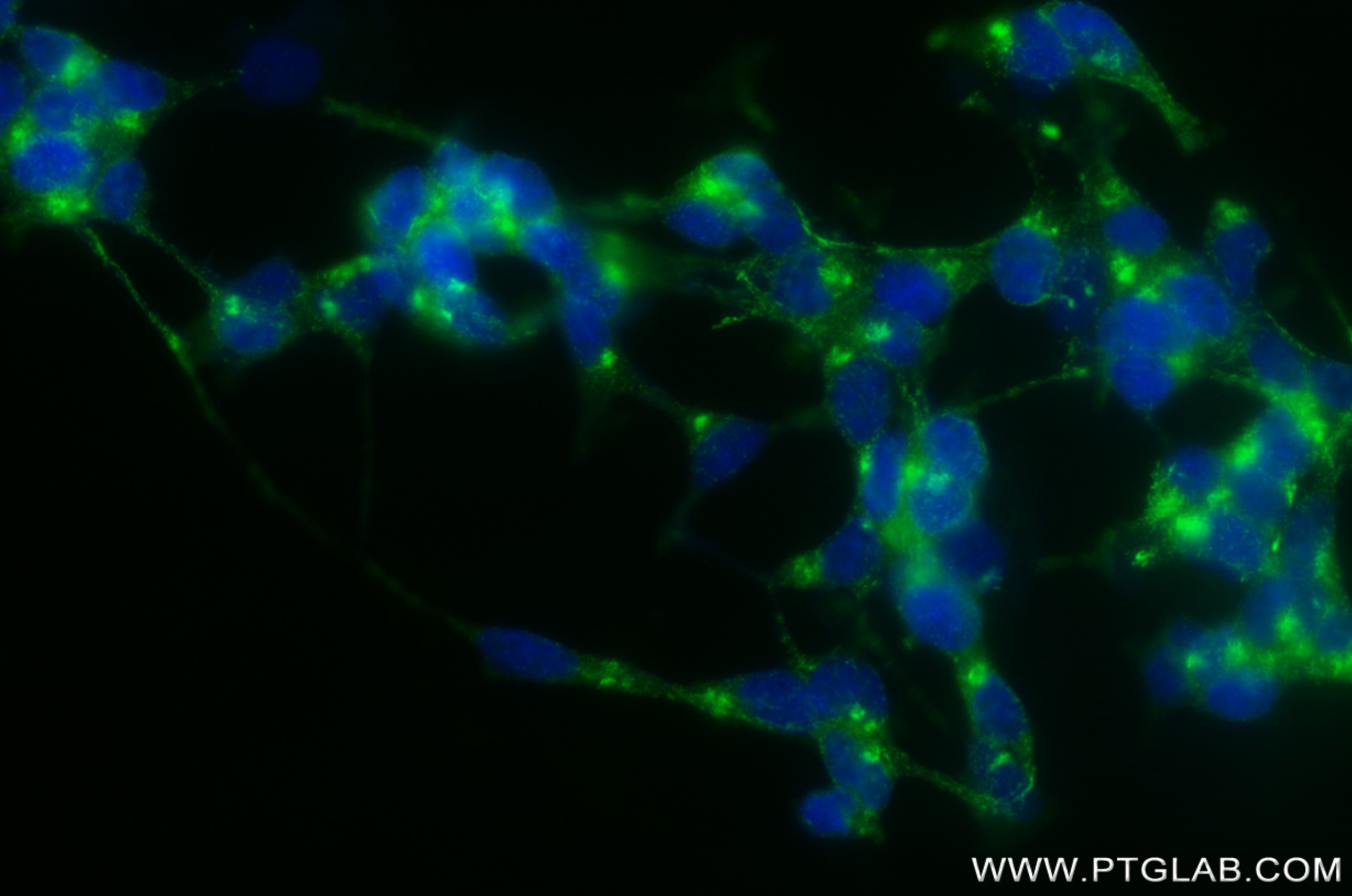 IF Staining of SH-SY5Y using 82925-2-RR