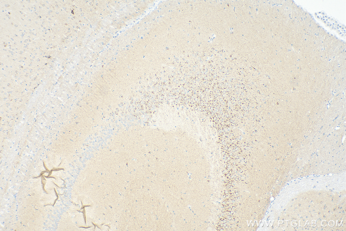 STMN2