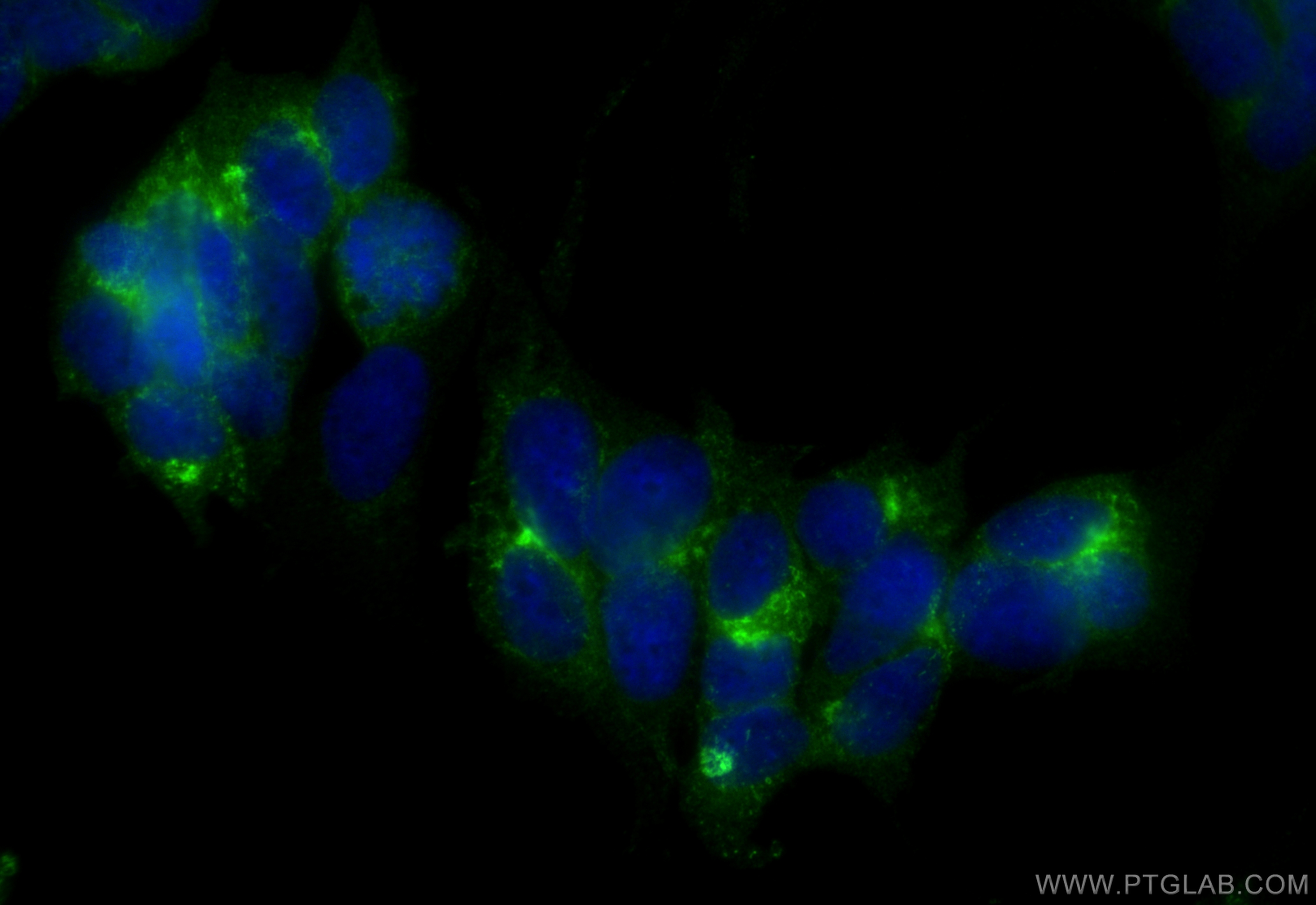 IF Staining of SH-SY5Y using RMX00021