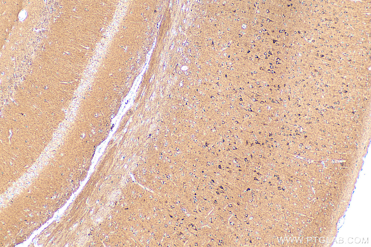 IHC staining of mouse brain using RMX00021