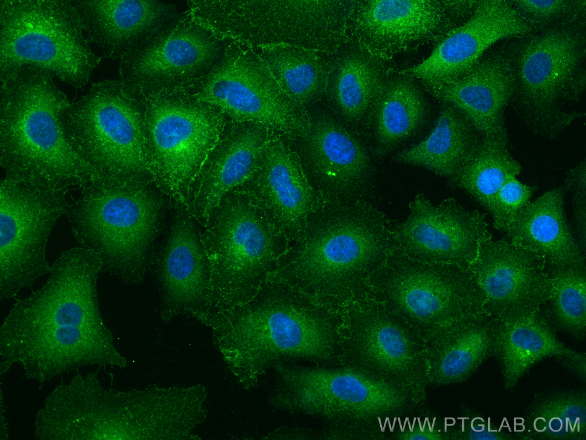 IF Staining of A549 using 12046-1-AP