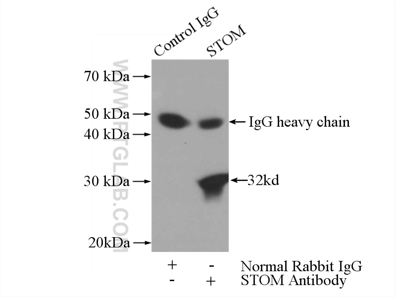 IP experiment of HeLa using 12046-1-AP