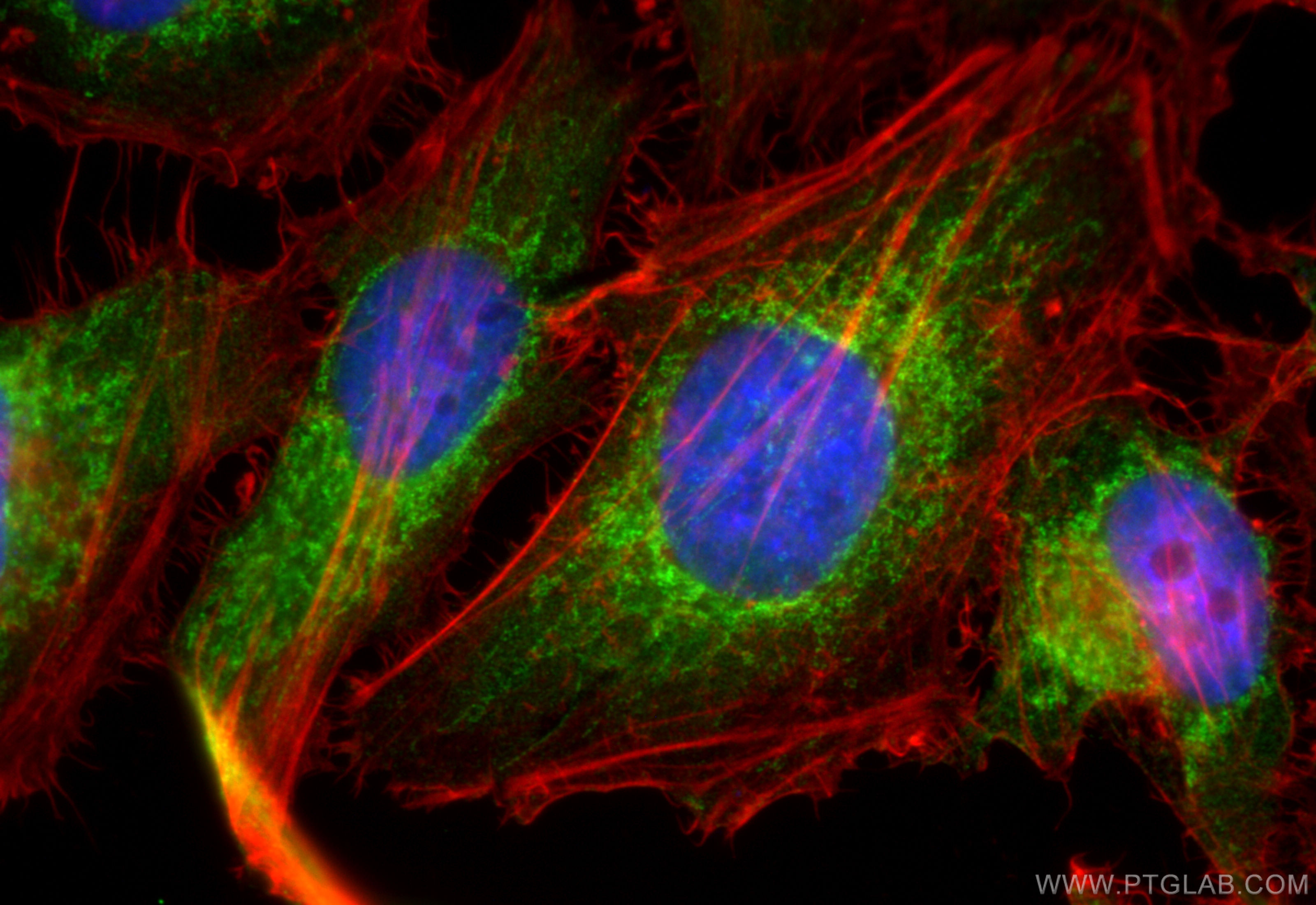 IF Staining of HeLa using 10348-1-AP