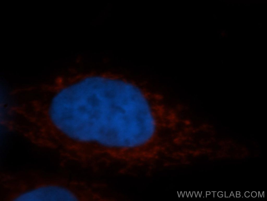 IF Staining of MCF-7 using 10348-1-AP