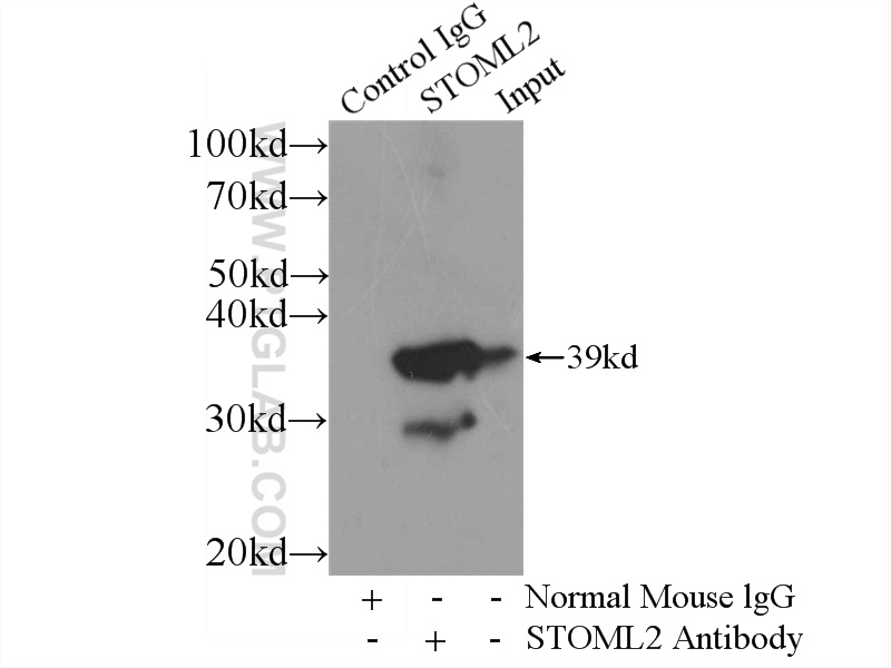 IP experiment of mouse brain using 60052-1-Ig (same clone as 60052-1-PBS)