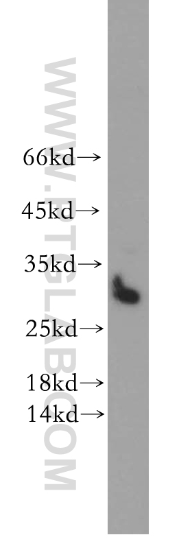 WB analysis of HeLa using 13316-1-AP