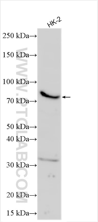WB analysis using 55146-1-AP