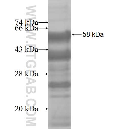 STOX1 fusion protein Ag6138 SDS-PAGE STOX1 fusion protein Ag6138 SDS-PAGE