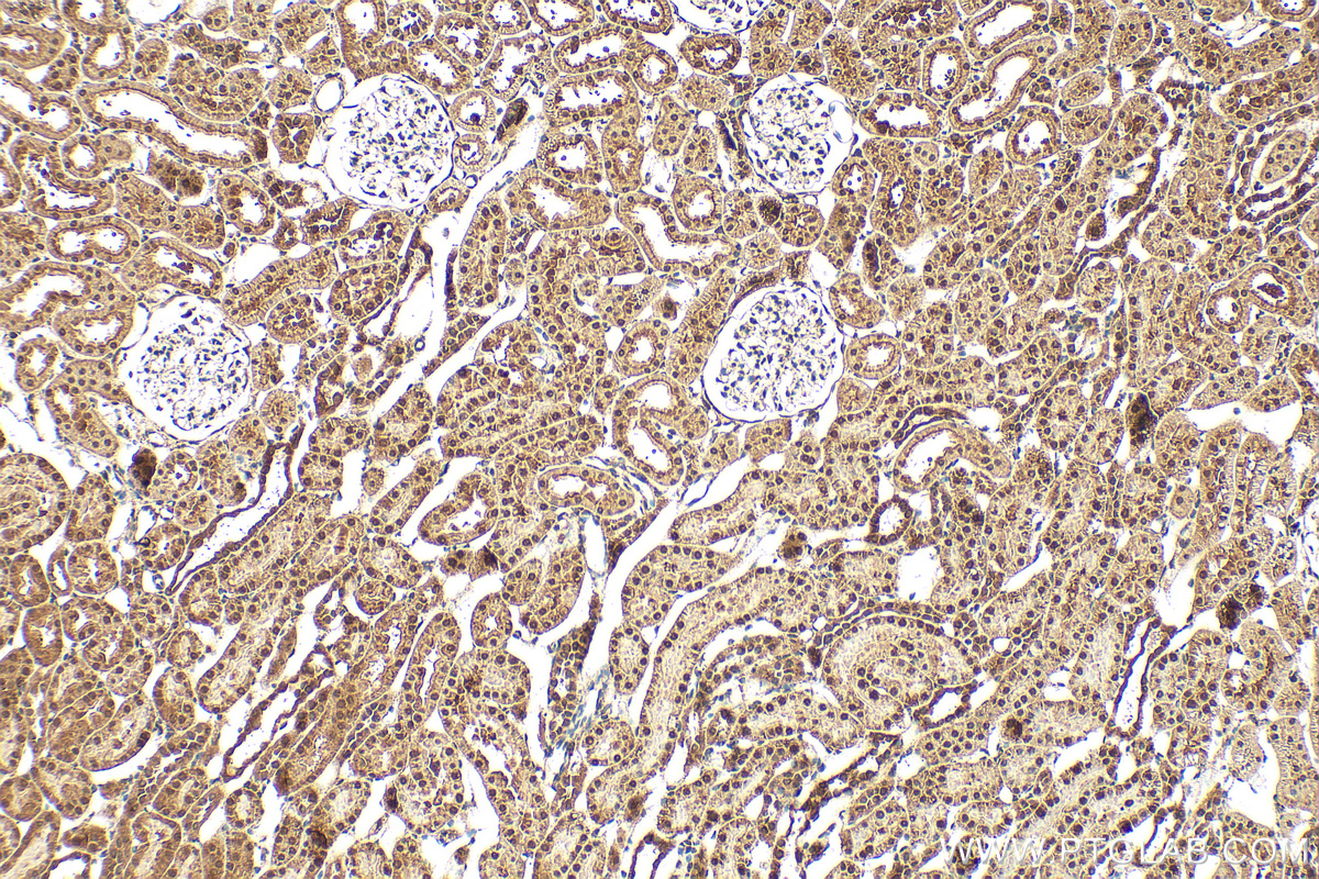 IHC staining of rat kidney using 32724-1-AP