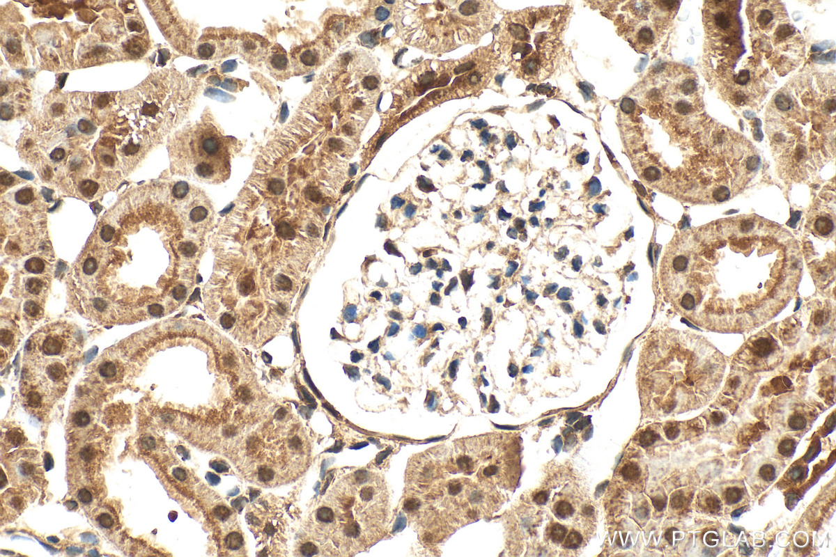 IHC staining of rat kidney using 32724-1-AP
