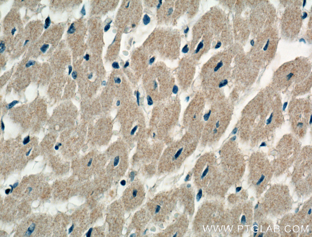IHC staining of human heart using 10688-1-AP
