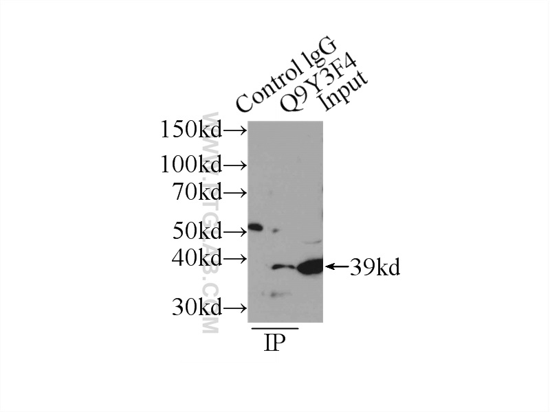 IP experiment of HeLa using 18277-1-AP