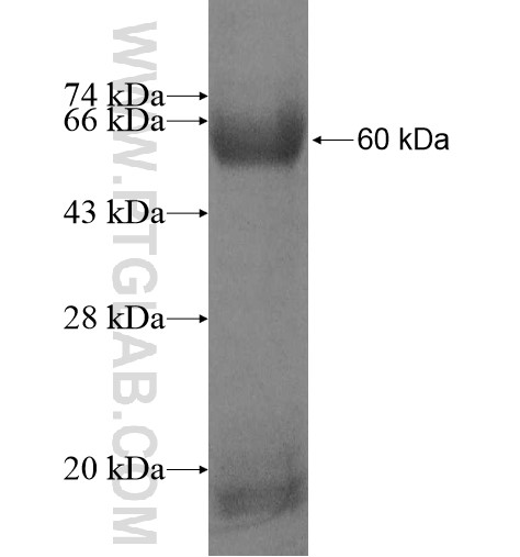 STRBP fusion protein Ag10720 SDS-PAGE
