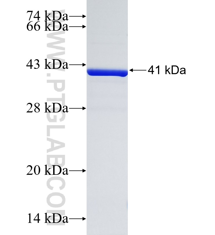 STRC fusion protein Ag34771 SDS-PAGE STRC fusion protein Ag34771 SDS-PAGE