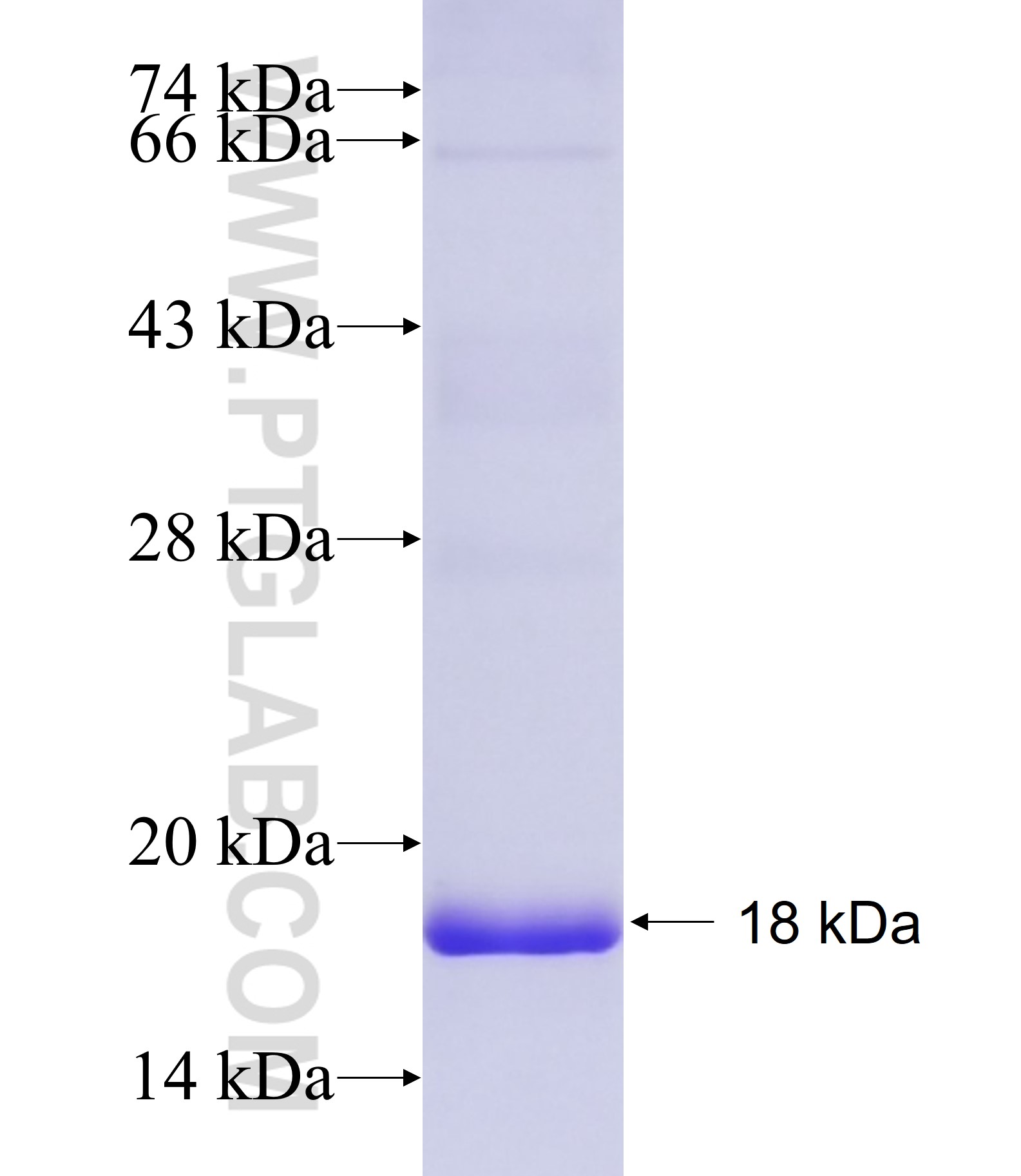 STRC fusion protein Ag34795 SDS-PAGE STRC fusion protein Ag34795 SDS-PAGE