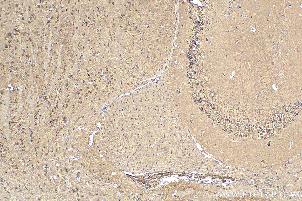 IHC staining of mouse brain using 21624-1-AP